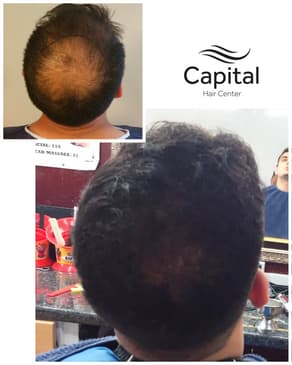 Slider image (9) Capital Hair Center